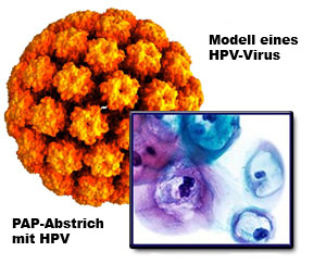 HPV-Virus